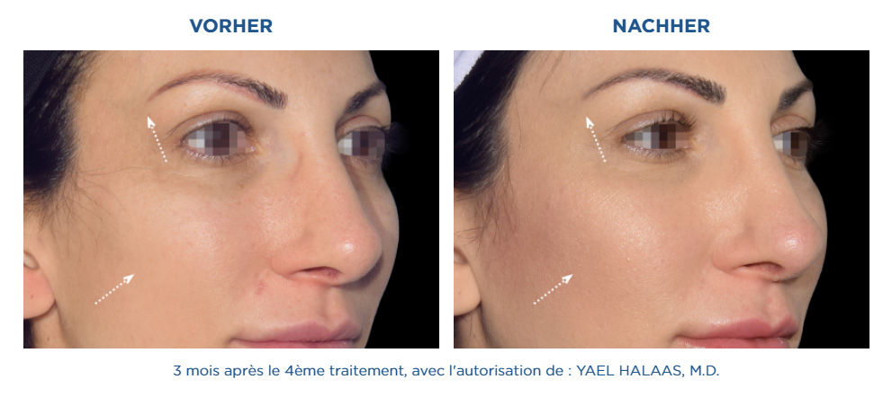 Full Face